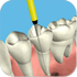 RootCanal